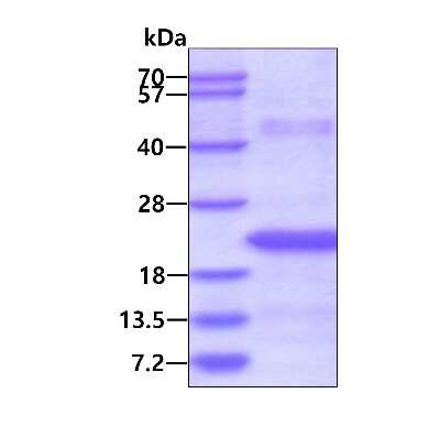 SDS-PAGE: Recombinant Human MED21 His Protein [NBP2-23221]